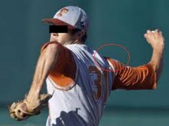 Immagine Dolore spalla